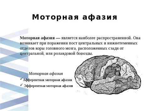 Группы симптомов моторной афазии