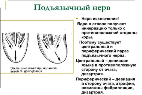 Девиация языка вправо