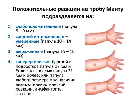 Декодирование результатов манту: норма и отклонения