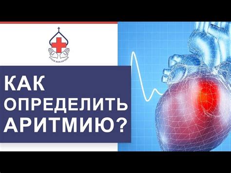 Диагностика: как определить аритмию и ее форму