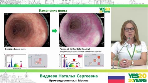 Диагностика атрофии плоского эпителия