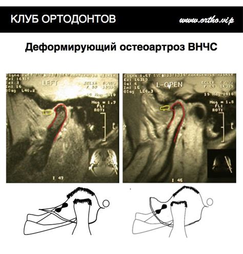 Диагностика внутренних толчков