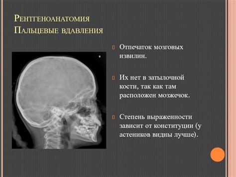 Диагностика внутричерепной гипертензии