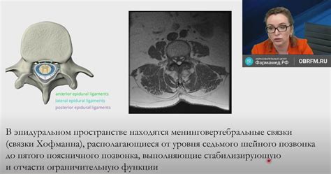 Диагностика выраженных дегенеративно-дистрофических изменений