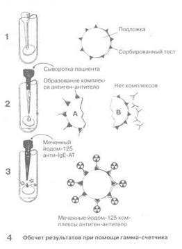 Диагностика высокого содержания аллерген-специфических IgE