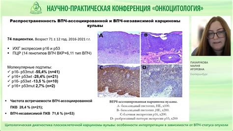 Диагностика высокодифференцированной карциномы