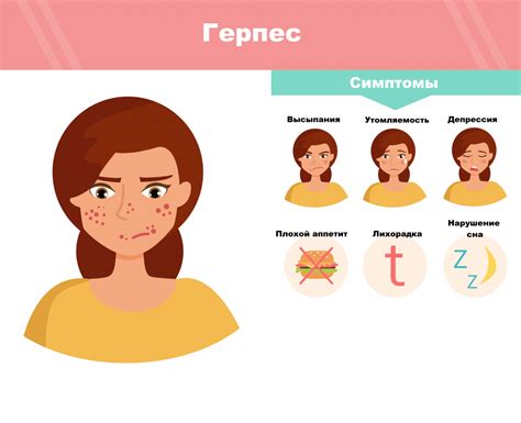 Диагностика герпеса 6 у детей