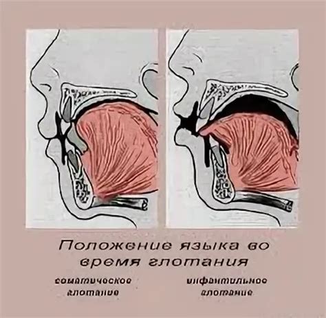 Диагностика глотательных нарушений