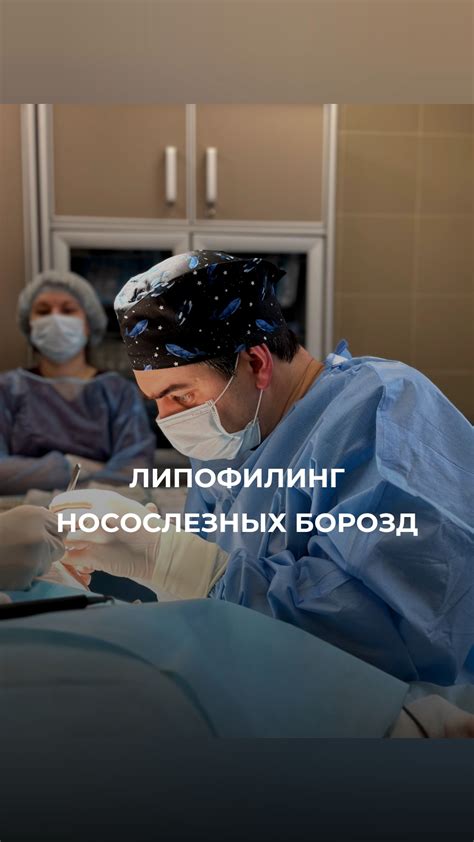 Диагностика глубоких носослезных борозд