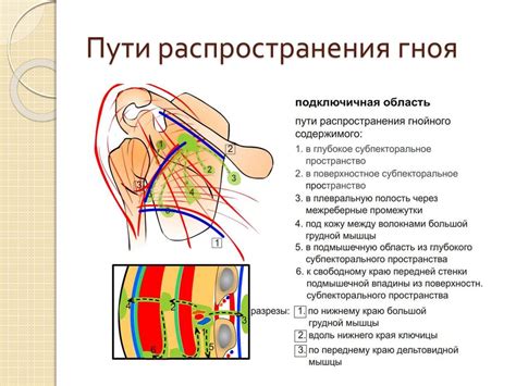 Диагностика гноя на верхней конечности: методы и признаки