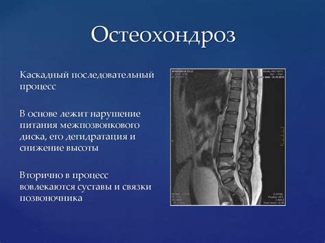 Диагностика защемления позвоночника