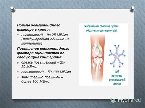 Диагностика и значения ревматоидного фактора минус