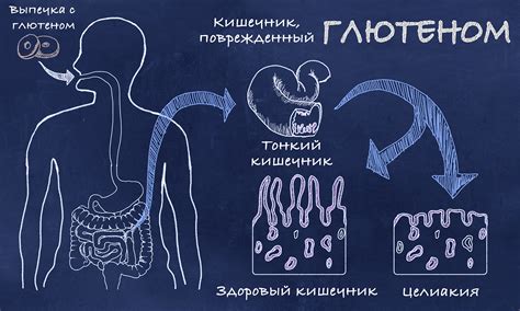 Диагностика и лечение глютеновой энтеропатии