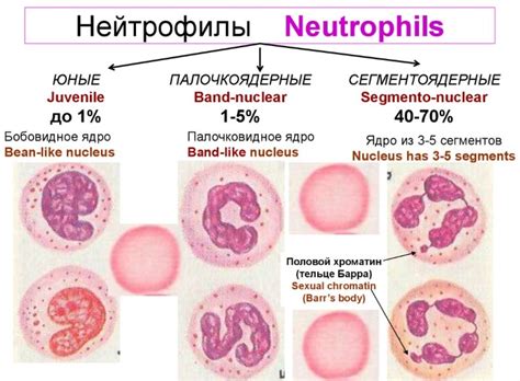 Диагностика и лечение нейтрофильного лейкоцитоза со сдвигом влево