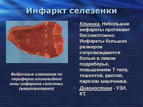 Диагностика и лечение объемного образования селезенки