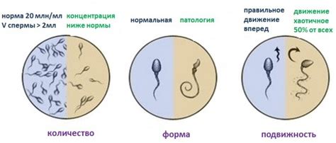 Диагностика и лечение отсутствия спермы у мужа