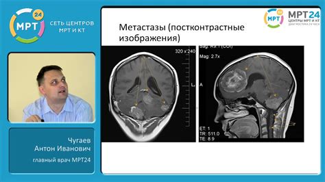 Диагностика и обследование наростов на голове