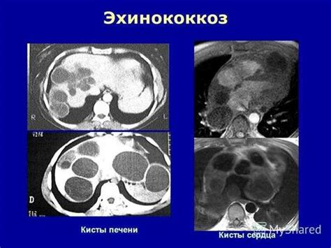 Диагностика и обследование печени и холедоха