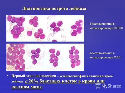 Диагностика наличия незрелых клеток в крови