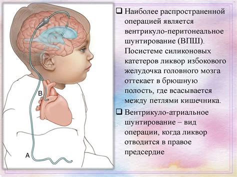 Диагностика невыраженной гидроцефалии