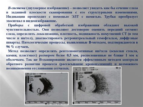 Диагностика немых глаз