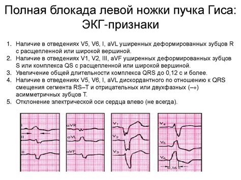 Диагностика неполной блокады правой ножки у ребенка