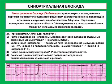 Диагностика неспецифического нарушения ЭКГ