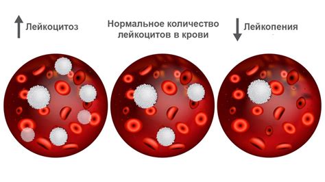 Диагностика низкого количества лейкоцитов