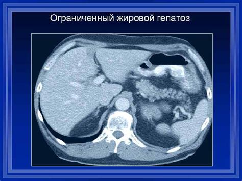 Диагностика новых образований