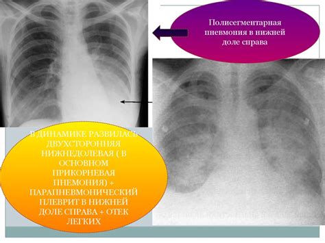 Диагностика органов грудной клетки без видимой патологии