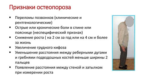 Диагностика остеопении у женщин после 50 лет