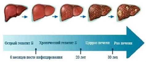 Диагностика отказа печени