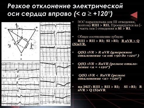 Диагностика отклонения вправо