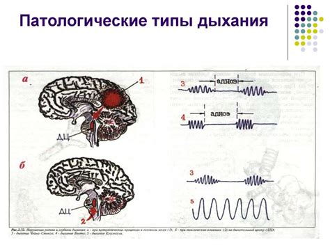 Диагностика отсутствия патологических форм: