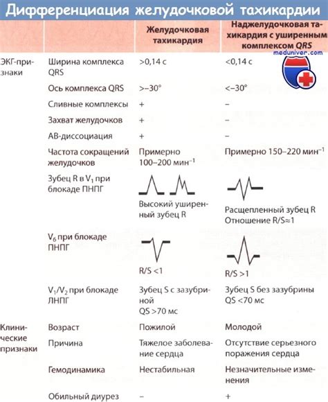 Диагностика пароксизма желудочковой тахикардии: методы обследования