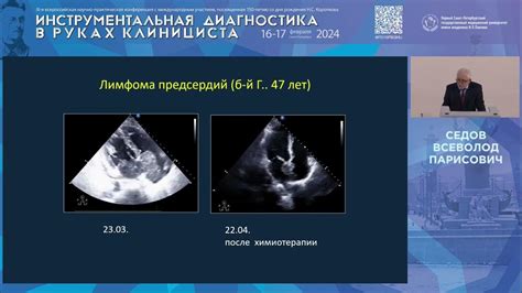 Диагностика патологических цилиндров