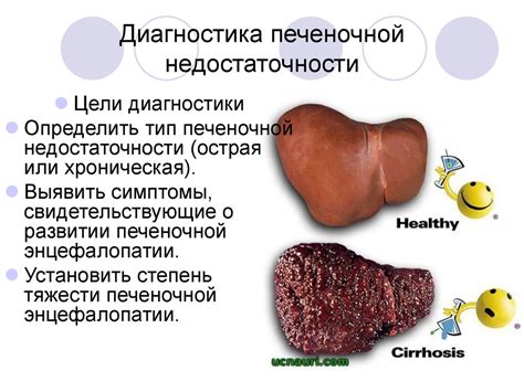 Диагностика печеночной недостаточности класса С