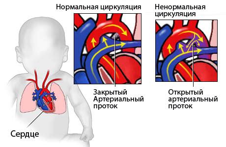 Диагностика поворота сердца у ребенка