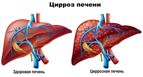 Диагностика повышенной щелочной фосфатазы у лошади