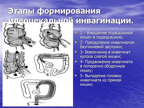 Диагностика просанивания кишечника