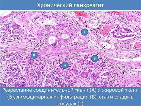 Диагностика разрастания соединительной ткани