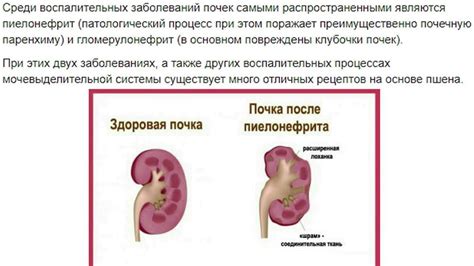 Диагностика расширения чашечки почки