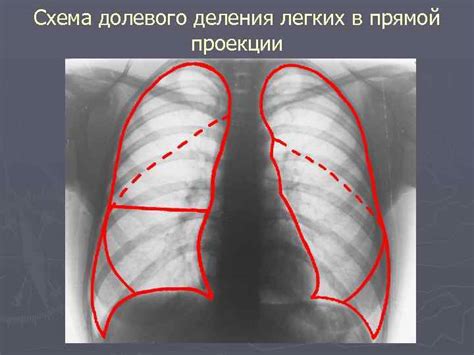 Диагностика расширенных сосудов легких