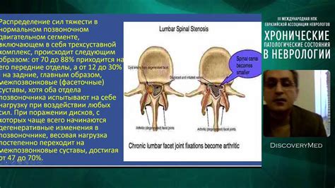 Диагностика сакроилеита: методы выявления и оценки