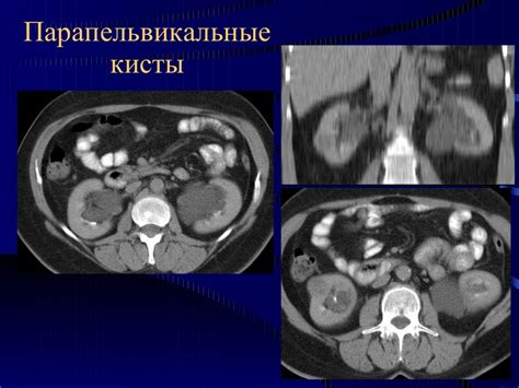 Диагностика структурного изменения почки