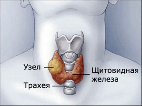 Диагностика увеличения щитовидной железы