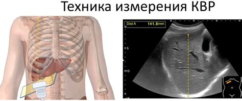 Диагностика увеличенной левой доли печени у мужчин