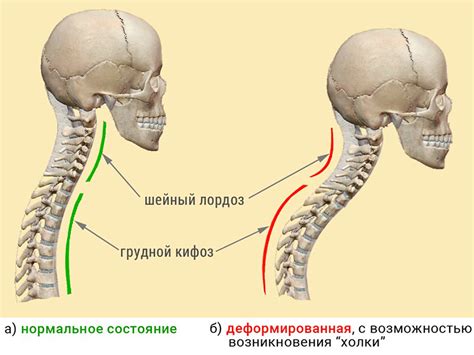 Диагностика шейного лордоза