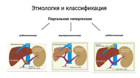 Диагностирование портальной гипертензии: методы и исследования