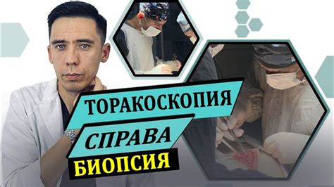 Диагностическая торакоскопия